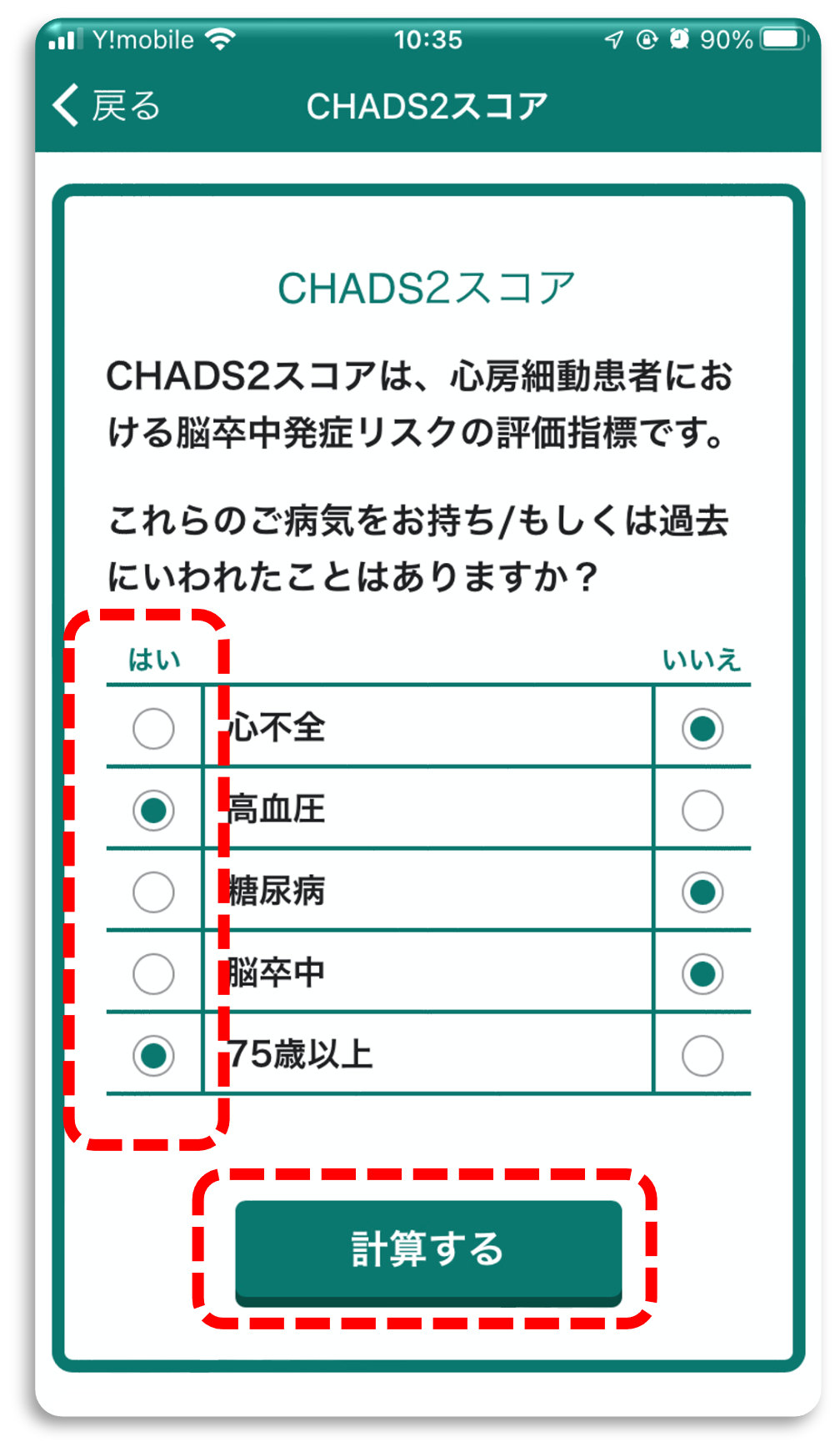 心房細動アプリ