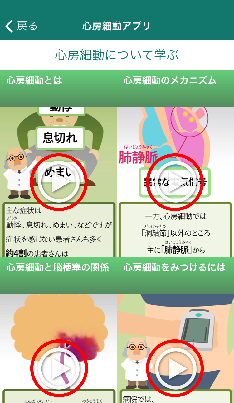 心房細動アプリ