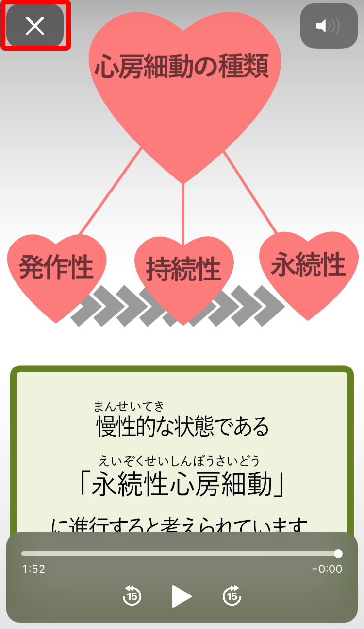 心房細動アプリ